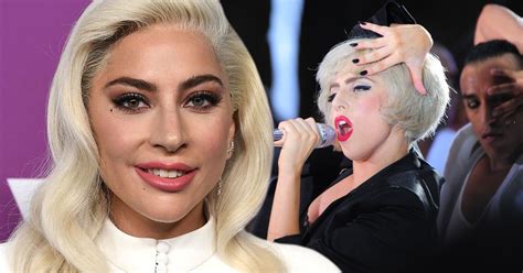 lady gaga surgery|The Truth About Lady Gagas Plastic Surgery Rumors。